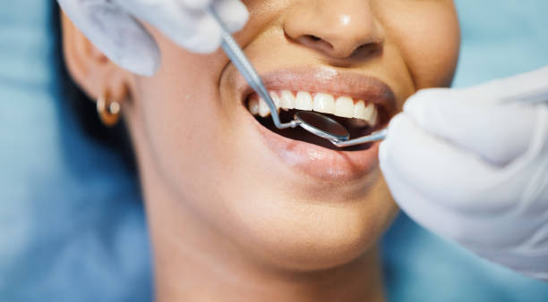 Best Knocked-Out Tooth Emergency  in Pato, WA