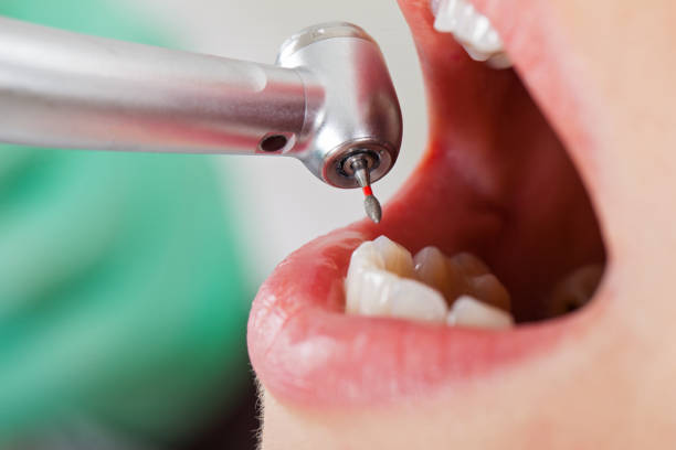 Best Cracked Tooth Emergency Dentist  in Pato, WA